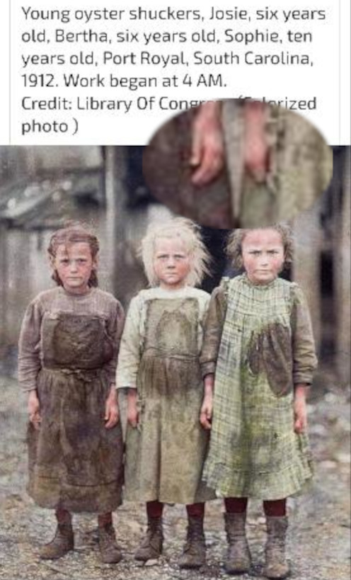 Child laborers, with hands mangled in industrial accidents.